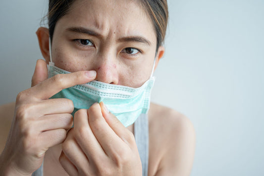 5 Best Masks for Fighting Maskne (Mask Acne)